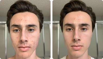 Transformation preview